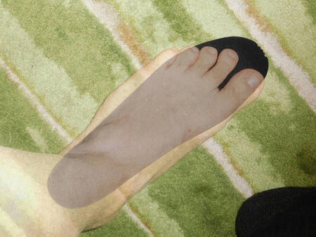 Foot shape versus insole